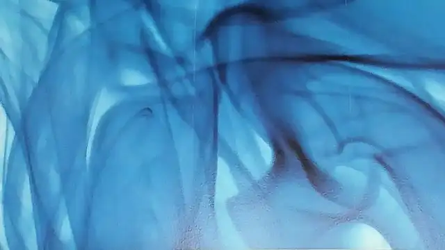 SkinnyDolly online show from 11/20/25, 03:07