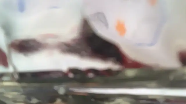 apachai test online show from 06/09/26, 11:11